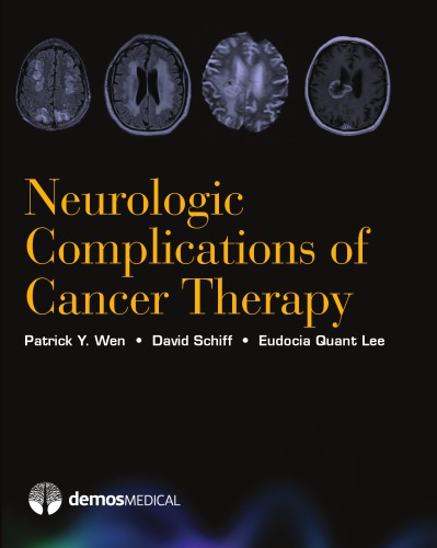 Neurologic Complications of Cancer Therapy 2011