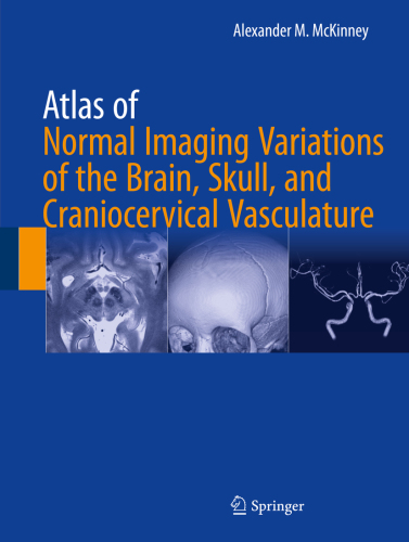 Atlas of Normal Imaging Variations of the Brain, Skull, and Craniocervical Vasculature 2018