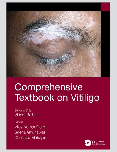 Comprehensive Textbook on Vitiligo 2020