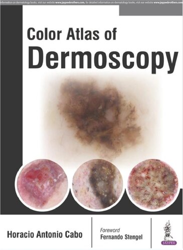 Color Atlas of Dermoscopy 2017