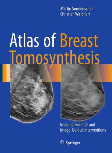 Atlas of Breast Tomosynthesis: Imaging Findings and Image-Guided Interventions 2017