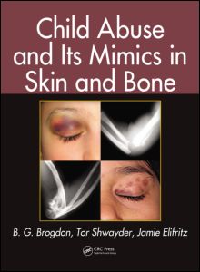 Child Abuse and its Mimics in Skin and Bone 2012