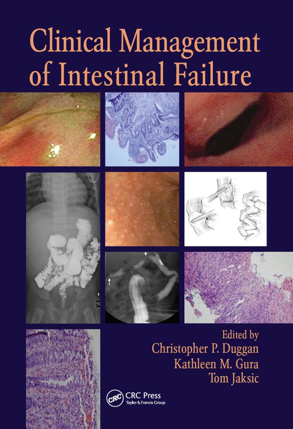 Clinical Management of Intestinal Failure 2011