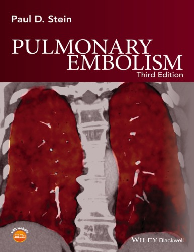 Pulmonary Embolism 2016