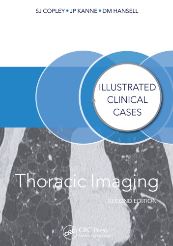 Thoracic Imaging: Illustrated Clinical Cases, Second Edition 2014