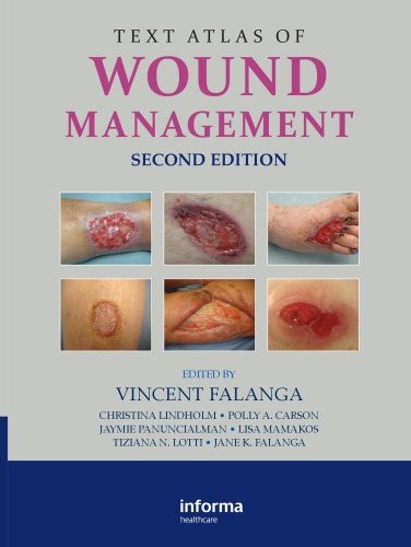 Text Atlas of Wound Management, Second Edition 2012