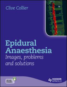 Epidural Anaesthesia: Images, Problems and Solutions 2012