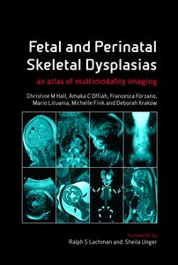 Fetal and Perinatal Skeletal Dysplasias: An Atlas of Multimodality Imaging 2012