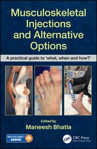 Musculoskeletal Injections and Alternative Options: A Practical Guide to 'what, when and How?' 2019