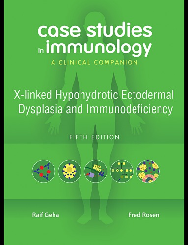 Case Studies in Immunology: X-linked Hypohydrotic Ectodermal Dysplasia and Immunodeficiency: A Clinical Companion 2010