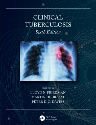 Clinical Tuberculosis 2020