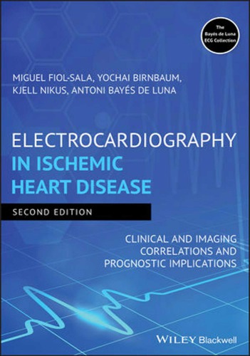 Electrocardiography in Ischemic Heart Disease: Clinical and Imaging Correlations and Prognostic Implications 2019