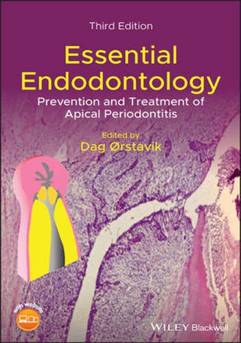 Essential Endodontology: Prevention and Treatment of Apical Periodontitis 2020