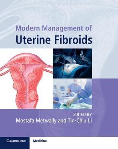Modern Management of Uterine Fibroids 2020