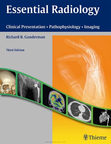 Essential Radiology: Clinical Presentation, Pathophysiology, Imaging 2014
