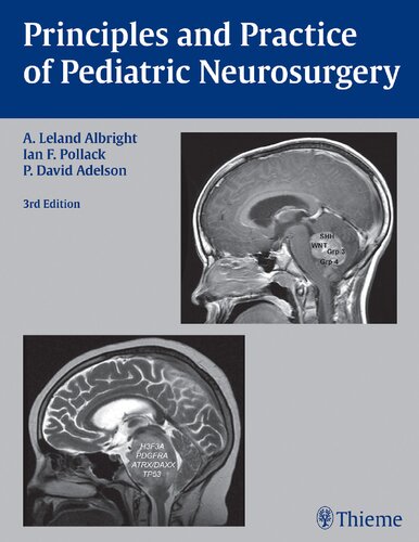اصول و شیوه های جراحی مغز و اعصاب کودکان
