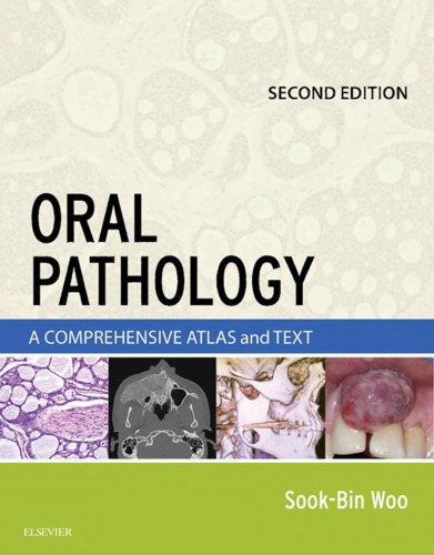 Oral Pathology: A Comprehensive Atlas and Text 2016