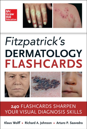 Fitzpatricks Dermatology Flash Cards 2013