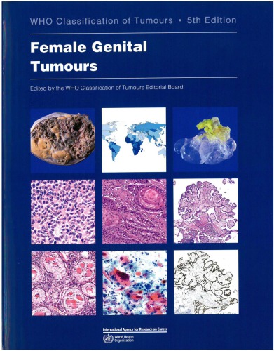 Female Genital Tumours 2020