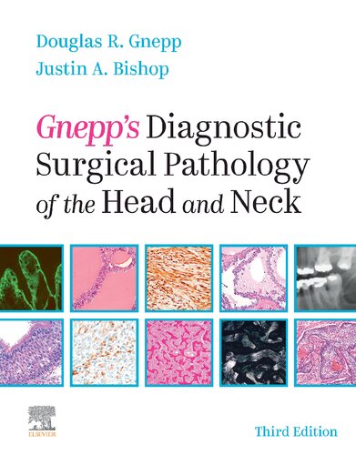 Gnepp's Diagnostic Surgical Pathology of the Head and Neck 2020