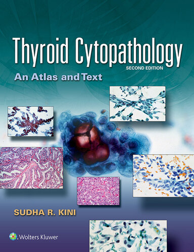 Thyroid Cytopathology: An Atlas and Text 2015