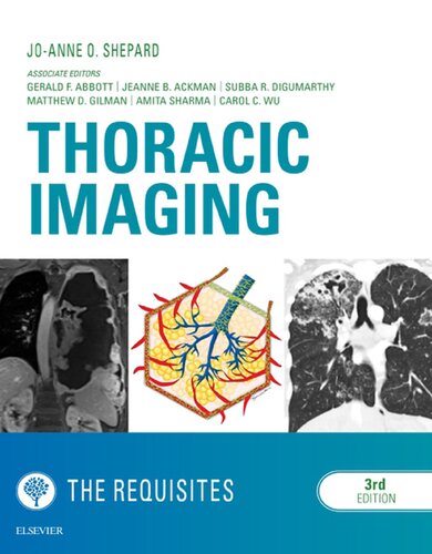 Thoracic Imaging the Requisites 2018