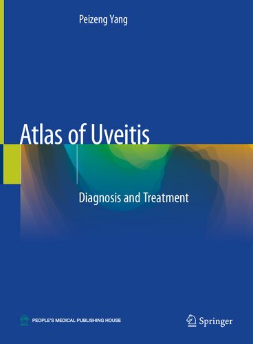 Atlas of Uveitis: Diagnosis and Treatment 2020