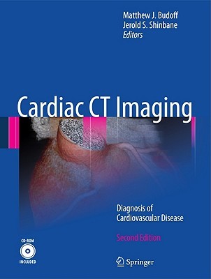 Cardiac CT Imaging: Diagnosis of Cardiovascular Disease 2006