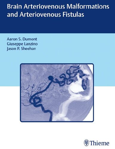 Brain Arteriovenous Malformations and Arteriovenous Fistulas 2017
