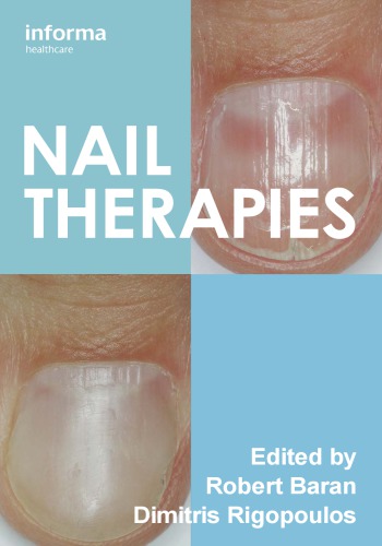 Nail Therapies 2012