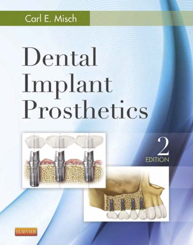 Dental Implant Prosthetics 2014