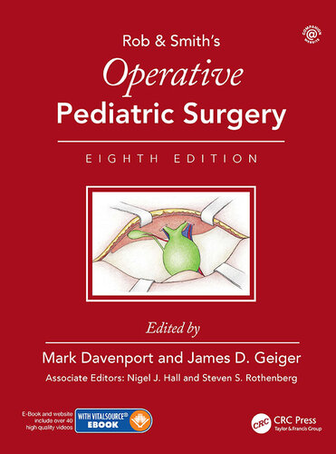 Operative Pediatric Surgery 2020