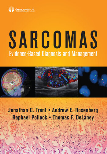 Sarcomas: Evidence-based Diagnosis and Management 2020