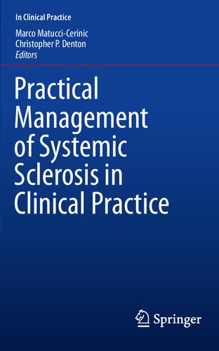 Practical Management of Systemic Sclerosis in Clinical Practice 2020