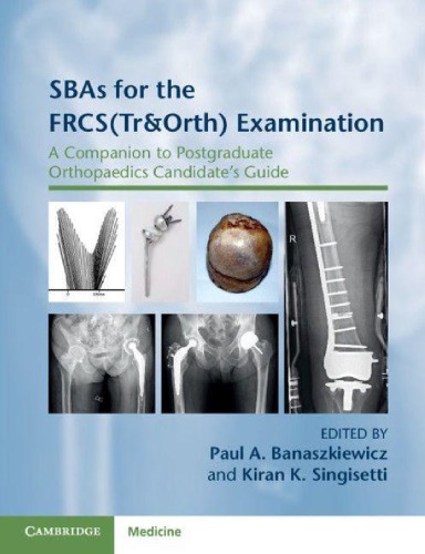 SBAs for the FRCS(Tr&Orth) Examination: A Companion to Postgraduate Orthopaedics Candidate's Guide 2020