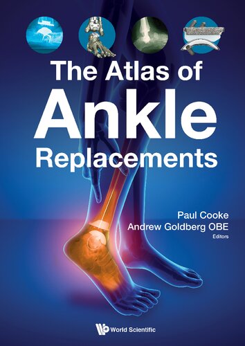 The Atlas of Ankle Replacements 2019