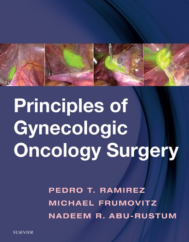 Principles of Gynecologic Oncology Surgery 2018
