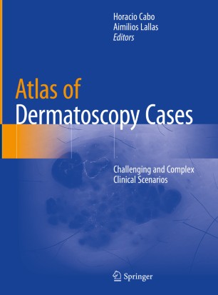 Atlas of Dermatoscopy Cases: Challenging and Complex Clinical Scenarios 2020