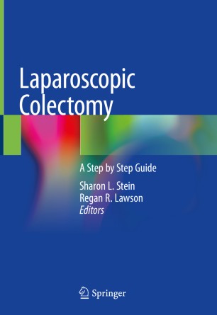 کولکتومی لاپاراسکوپی: راهنمای گام به گام