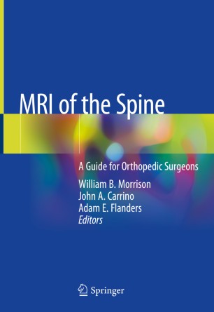 MRI of the Spine: A Guide for Orthopedic Surgeons 2020