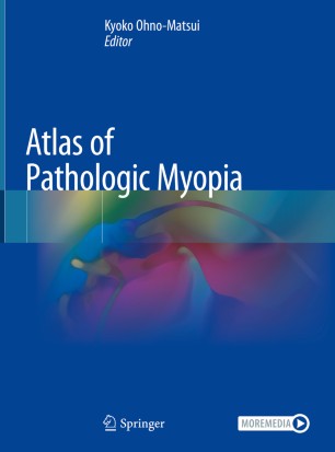 Atlas of Pathologic Myopia 2020