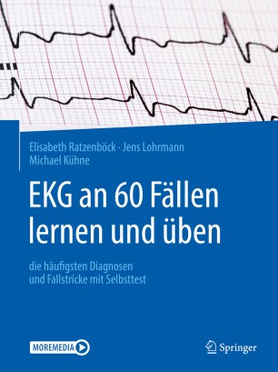 EKG an 60 Fällen lernen und üben: die häufigsten Diagnosen und Fallstricke mit Selbsttest 2020
