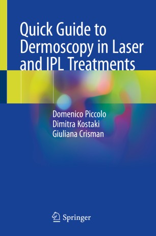 راهنمای سریع درماتوسکوپی در درمان های لیزر و IPL