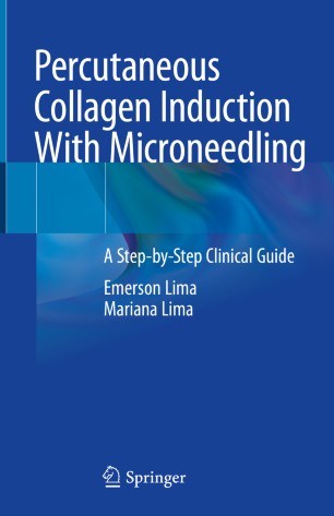Percutaneous Collagen Induction With Microneedling: A Step-by-Step Clinical Guide 2020