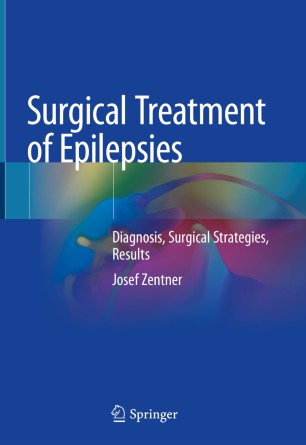 Surgical Treatment of Epilepsies: Diagnosis, Surgical Strategies, Results 2020