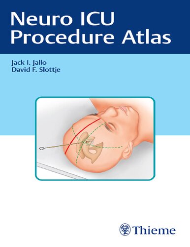Neuro ICU Procedure Atlas 2021