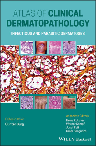 Atlas of Clinical Dermatopathology: Infectious and Parasitic Dermatoses 2021