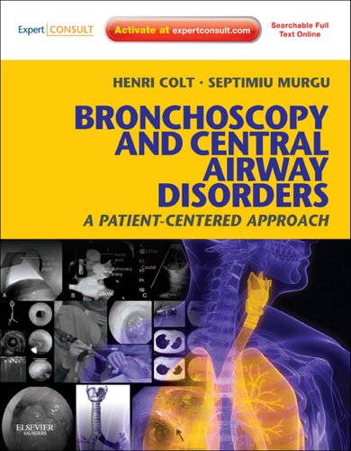 Bronchoscopy and Central Airway Disorders: A Patient-centered Approach 2012