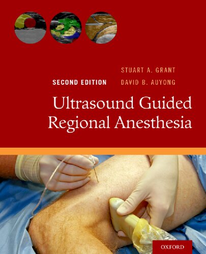 Ultrasound Guided Regional Anesthesia 2016