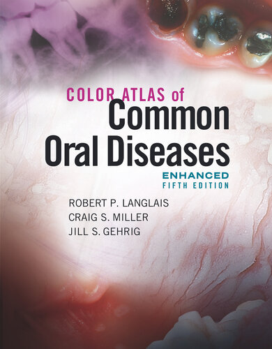 Color Atlas of Common Oral Diseases, Enhanced Edition 2020